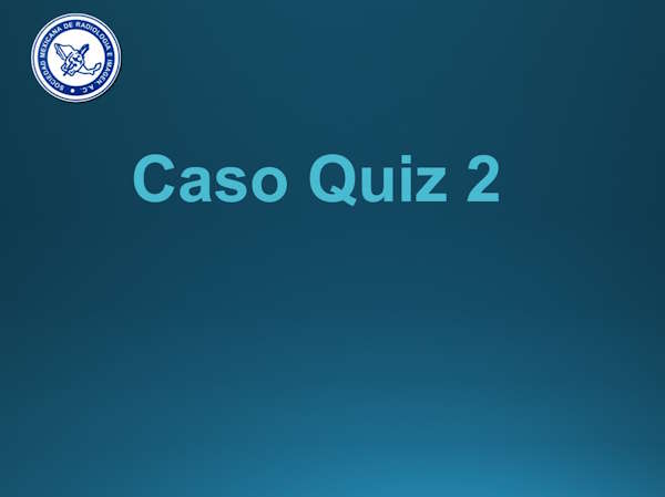Caso Quiz 2