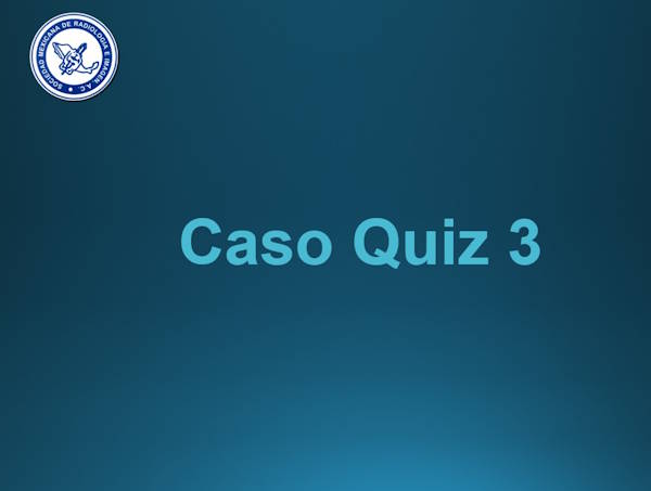 Caso Quiz 3