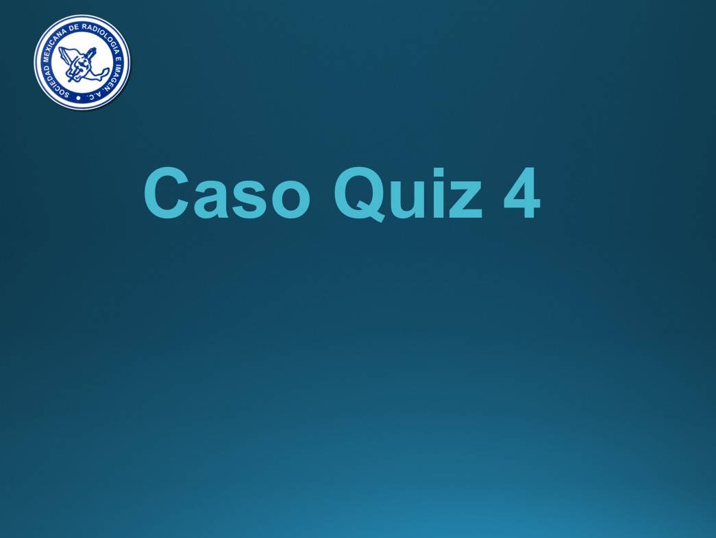 Caso Quiz 3