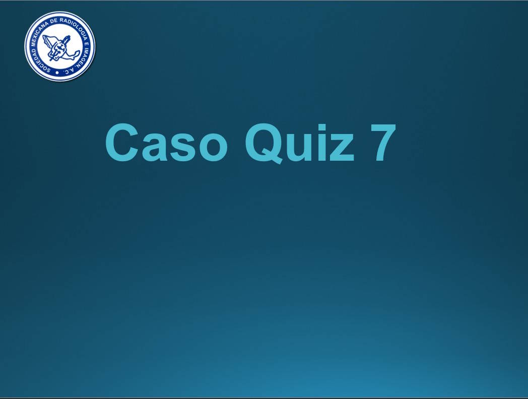 Caso Quiz 7