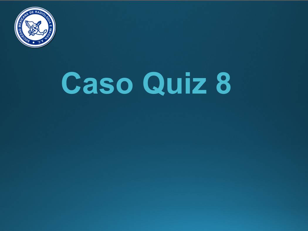 Caso Quiz 8