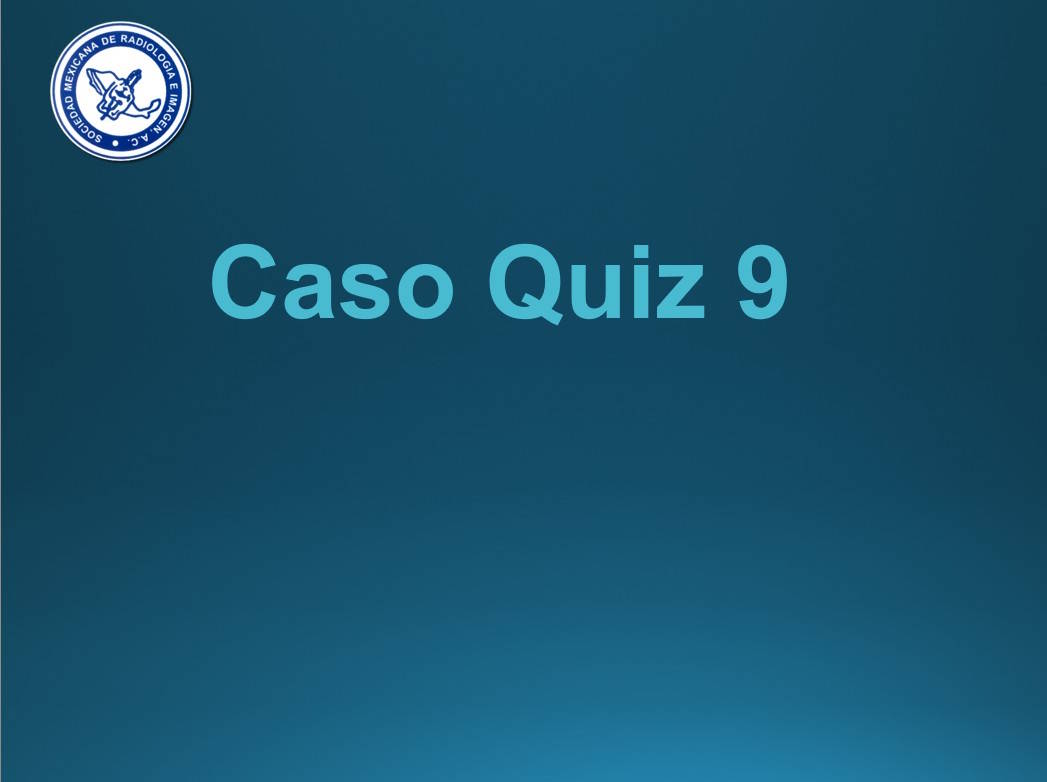 Caso Quiz 9